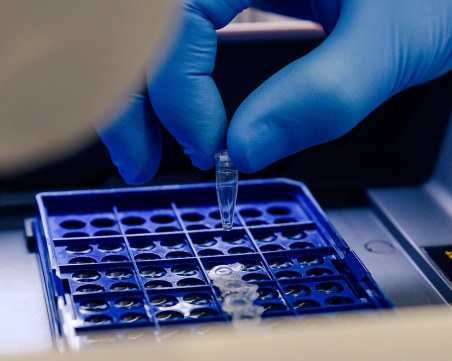 Лекар: Няма смисъл да си изследвате антителата