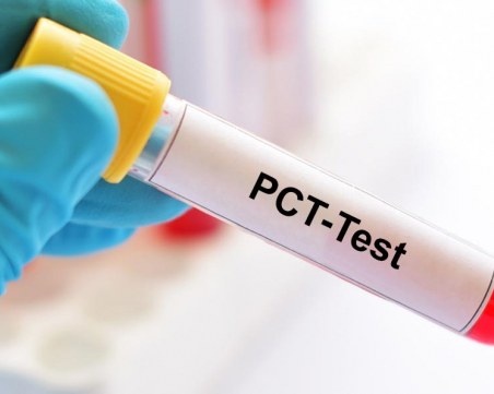 Арестуваха мъж, превърнал дома си във фалшива лаборатория за PCR тестове