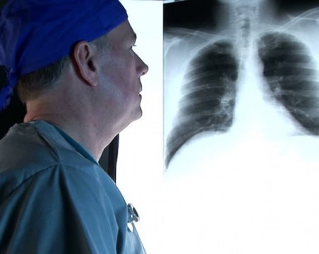 Започва месецът за борба с рака на белия дроб