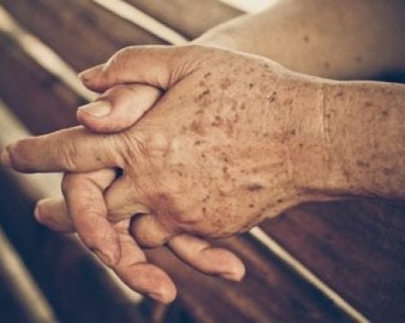 Как да премахнем старческите петна