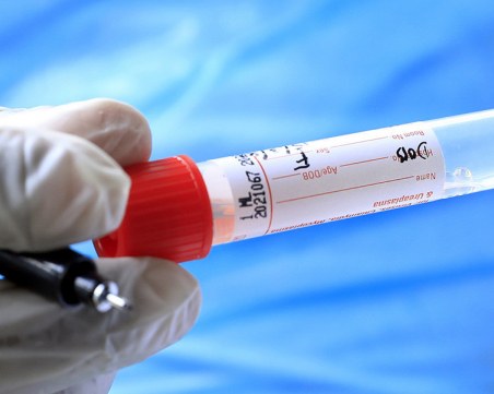 Рекорд на заразените с COVID за денонощие в света