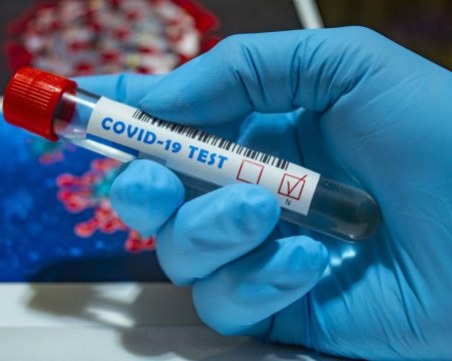 Жена с ХИВ е претърпяла 21 мутации на COVID-19