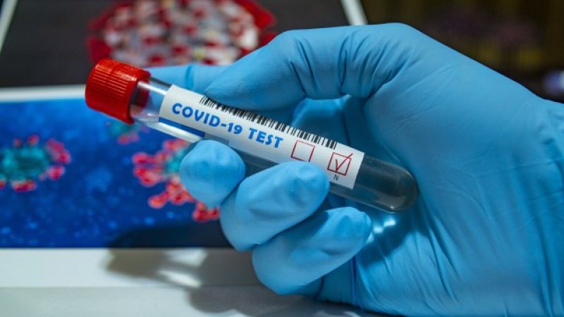 Жена с ХИВ е претърпяла 21 мутации на COVID-19
