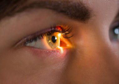 Коронавирусът може сериозно да засегне очите Съдовите заболявания на ретината като късен