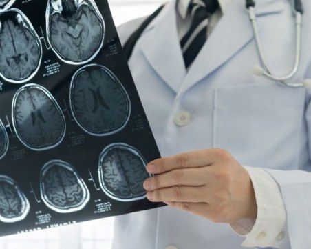 По-малко пациенти с инсулти в Пловдив в пандемията