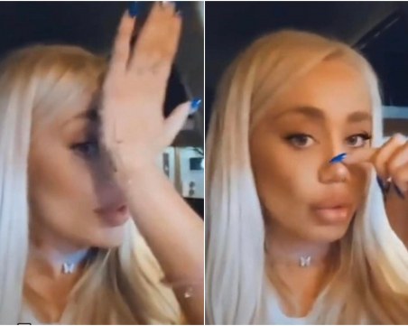 Теди Александрова: Емрах ми счупи носа, дължи ми 21 хиляди лева