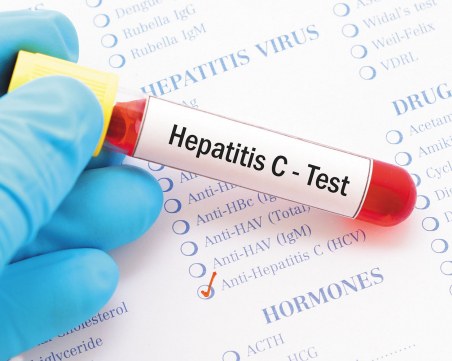 Установиха случай на остър хепатит с неизвестен произход в Румъния