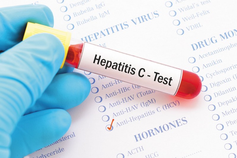 Установиха случай на остър хепатит с неизвестен произход в Румъния