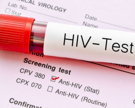 Безплатно тестване за СПИН в Пловдив