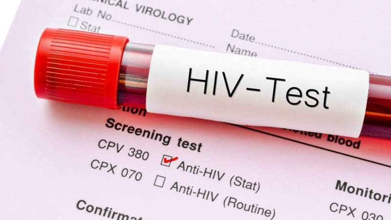 Безплатно тестване за СПИН в Пловдив