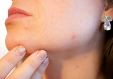 Кампанията за превенция на рака на кожата организира Българското дерматологично дружество в