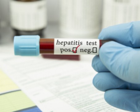 Отминал е пикът на опасния хепатит, случаите все по-малко