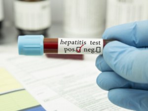 Отминал е пикът на опасния хепатит, случаите все по-малко