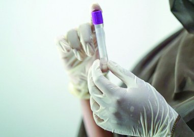 Случаят на маймунска шарка който Гърция обяви за съмнителен не