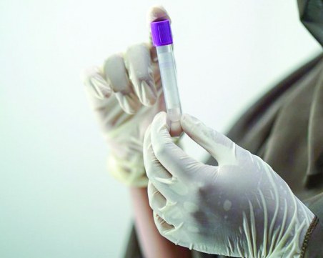 Няма случай на маймунска шарка в Гърция