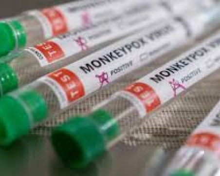 Във Франция ваксинираха двама контактни на вируса, причиняващ маймунска шарка