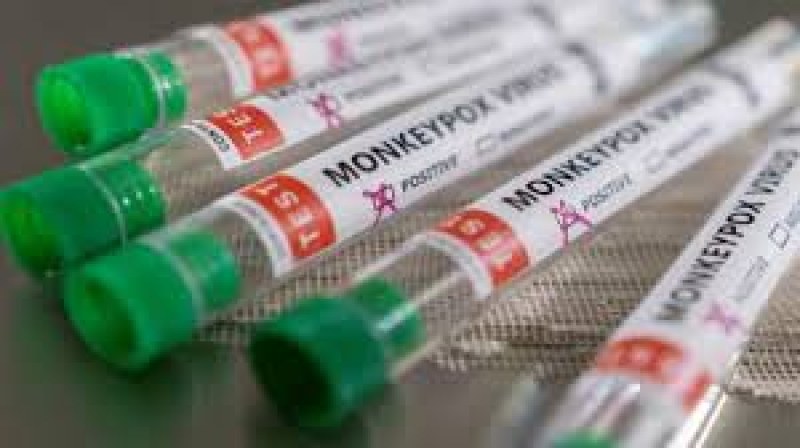 Във Франция ваксинираха двама контактни на вируса, причиняващ маймунска шарка