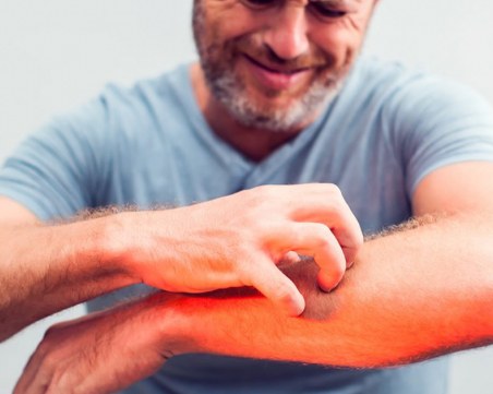 Зеленчукът, който гони кърлежите