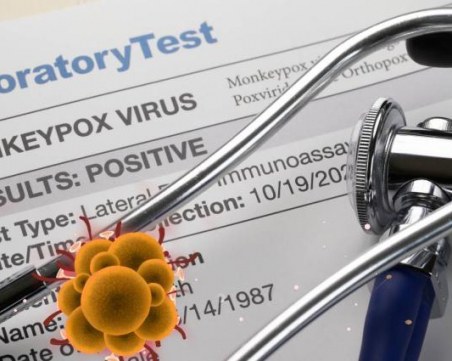 Подозрения за случай на маймунска шарка в Солун