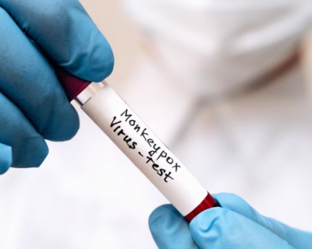 Първи случай на маймунска шарка в Румъния