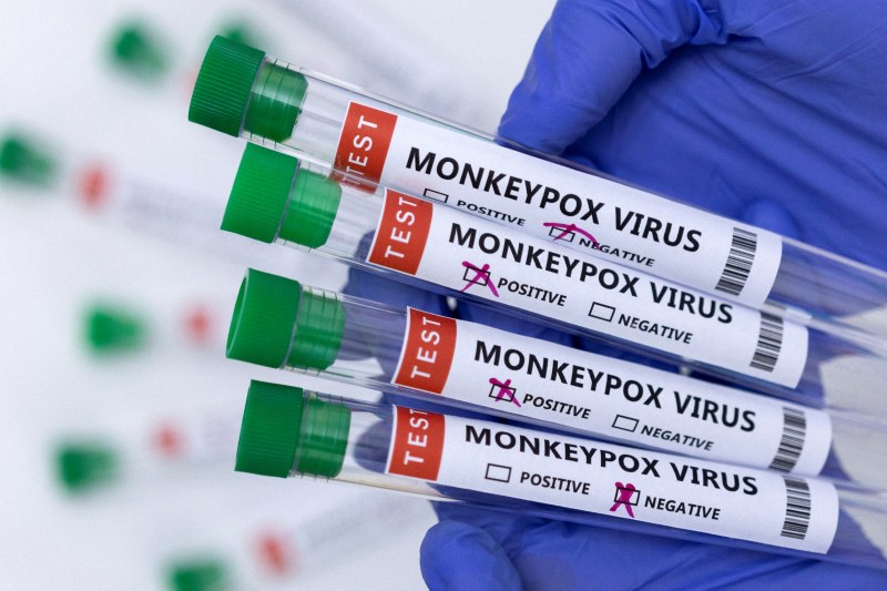 Китай издаде насоки за идентифицирането и лечението на маймунската шарка