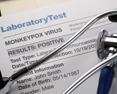 Първи случаи на маймунска шарка в България