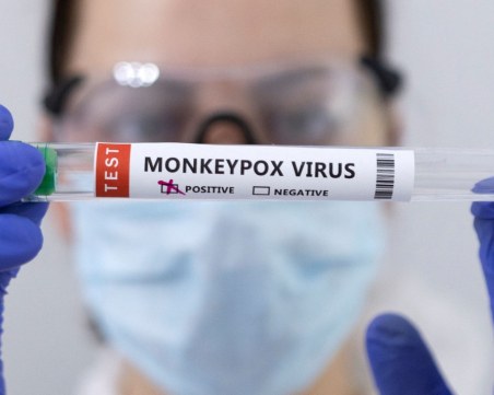 Третият пациент с маймунска шарка е приет във Военномедицинска академия