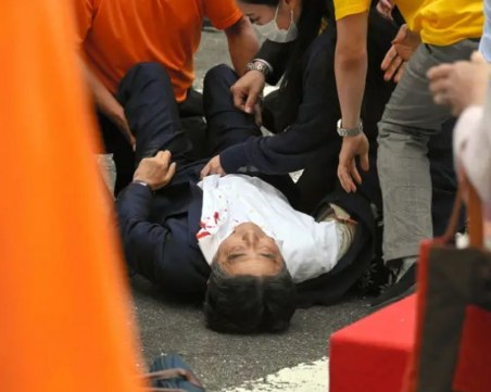 Състоянието на Шиндзо Абе е много тежко