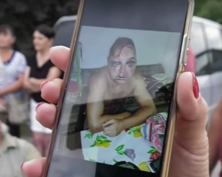 Мъж и жена пребиха почти до смърт свой съселянин