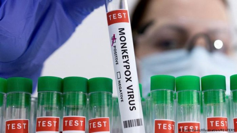 Испания започна да поставя ваксина срещу маймунската шарка. Извън Африка,