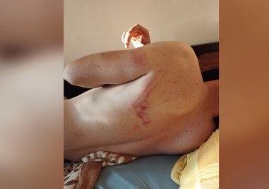 Млад мъж от Козлодуй се оплака от полицейско насилие На