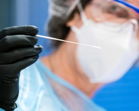 Италианец се зарази едновременно с маймунска шарка, COVID-19 и ХИВ