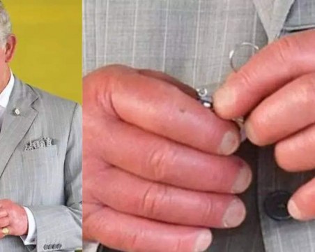 Каквo издават за здравето подутите ръце на Чарлз III