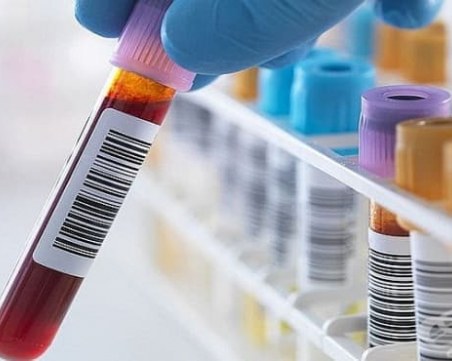 Стартират безплатни прегледи за туберкулоза в цялата страна