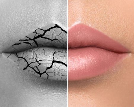 10 начина да предпазим и хидратираме устните си през есента и зимата