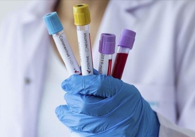 СOVID кризата в цифри данните от последното денонощие Прочетете още Брой на направени