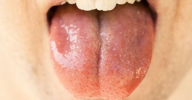 Развалени зъби, подути венци и рак на устната кухина: близо