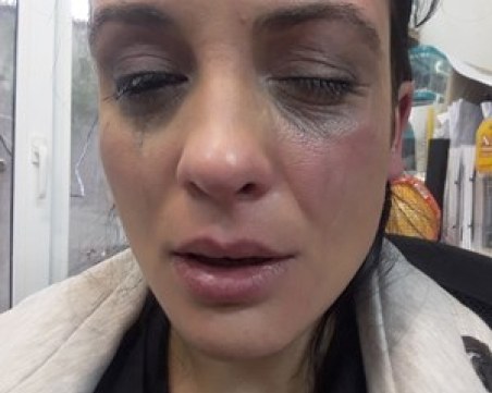 Диана Димитрова намекна, че Юлиян Вергов я е ударил