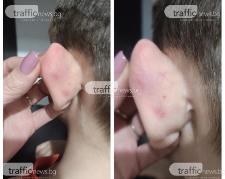 Дете е с наранявания по ухото, майката твърди, че учителка в детска градина в Пловдив му го е дърпала