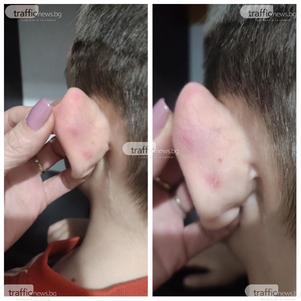 Дете е с наранявания по ухото, майката твърди, че учителка в детска градина в Пловдив му го е дърпала
