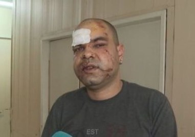 Побойникът който преби 37 годишният медик от врачанския спешен център