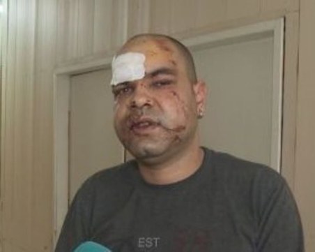 Роднина на семейството от ПТП-то със загинало дете край Враца пребил медика от спешния център