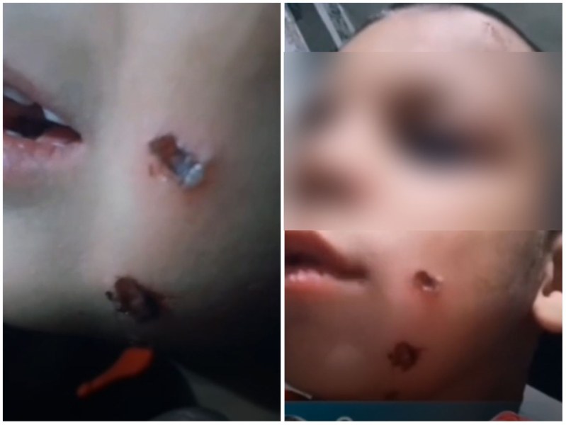 Видео с наранено невръстно дете в социалната мрежа ТикТок шокира