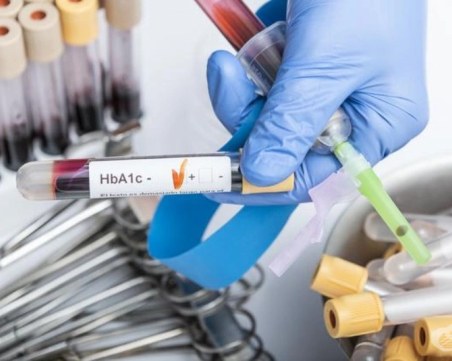 Пловдивска лаборатория изкара напълно здрава пловдивчанка болна от диабет