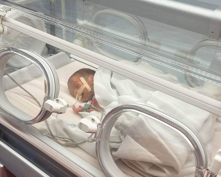 Пловдивски лекари се борят за живота на бебе, родено едва 1200 грама