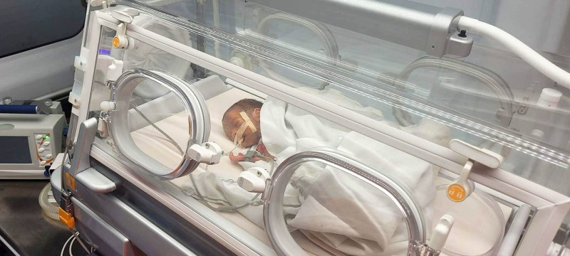 Пловдивски лекари се борят за живота на бебе, родено едва 1200 грама