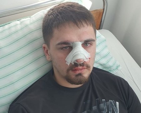 Демерджиев за полицаите пребили 19-годишен: Били са провокирани