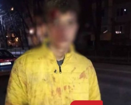 Баща преби приятеля на дъщеря си! Майка му подозира дискриминация