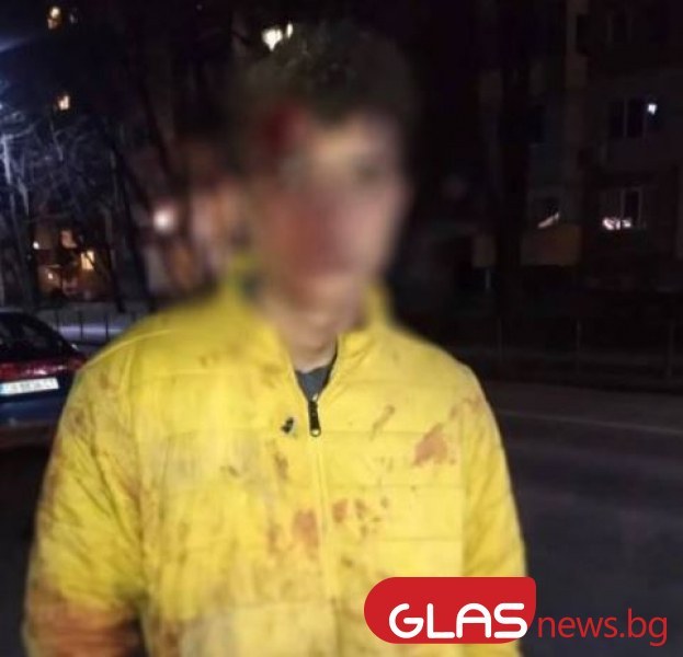 Баща преби приятеля на дъщеря си! Майка му подозира дискриминация