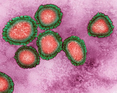 Мистериозна болест взе 5 жертви в Танзания
